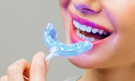 Ranking preparatów do wybielania zębów 2024